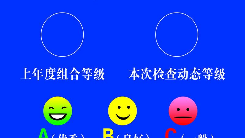 膨化食品机械材质：安全与效率的双重保障**